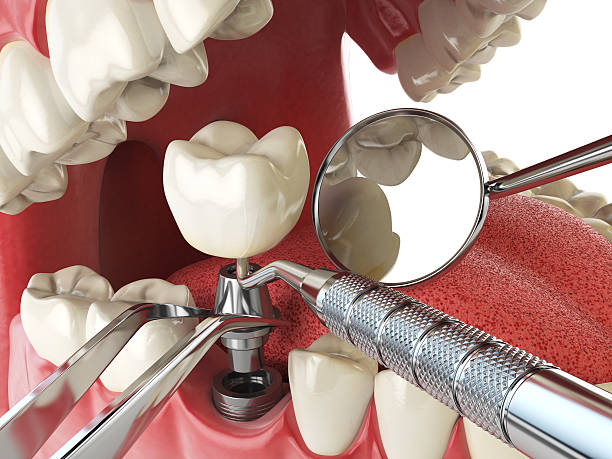 Best Urgent Tooth Repair  in Galax, VA